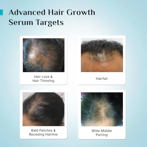 Pilgrim Redensyl 3% + Anagain 4% + Baicapil Advanced Hair Growth Serum (50ml) for Scalp with Korean Black Rice, Saw Palmetto | Control Hair Fall, Stimulate Hair Regrowth, Hair (50ml)