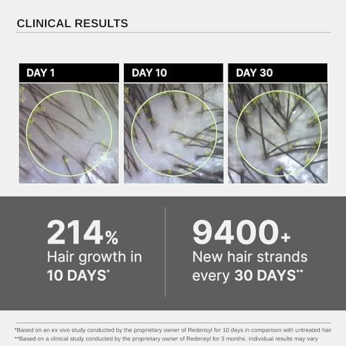 Bare Anatomy Advanced Hair Growth Serum | 3% Redensyl + 4% Anagain + 3% Baicapil + 1% Capilia Longa, Rosemary, Biotin & Rice Extract