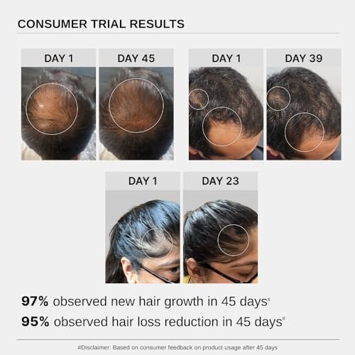 Bare Anatomy Advanced Hair Growth Serum | 3% Redensyl + 4% Anagain + 3% Baicapil + 1% Capilia Longa, Rosemary, Biotin & Rice Extract