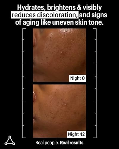 Allies of Skin Mandelic Pigmentation Corrector Night Serum