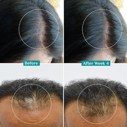 Pilgrim Redensyl 3% + Anagain 4% + Baicapil Advanced Hair Growth Serum (50ml) for Scalp with Korean Black Rice, Saw Palmetto | Control Hair Fall, Stimulate Hair Regrowth, Hair (50ml)